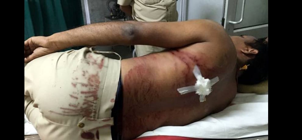 Unknowingly criminal hit the constable with a sharp knife at east patel nagar delhi