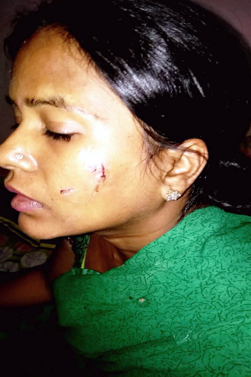 Looty chain by sharpening the face of the teacher on the face