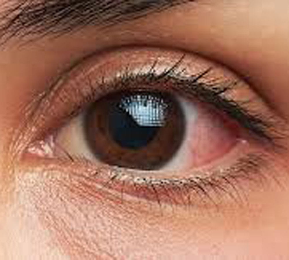 news research shows how contact lenses can make you blind