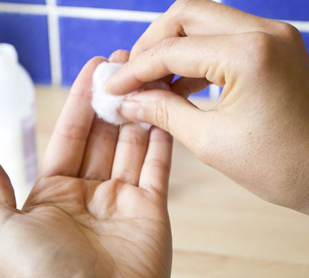 easy ways to get rid of peeling finger tips