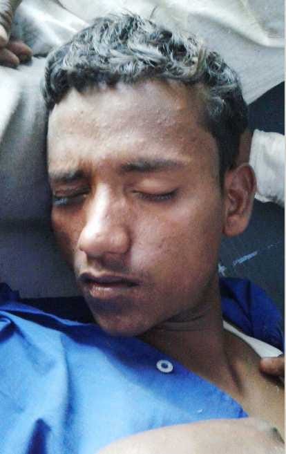 Youth shot in crop controversy, serious condition