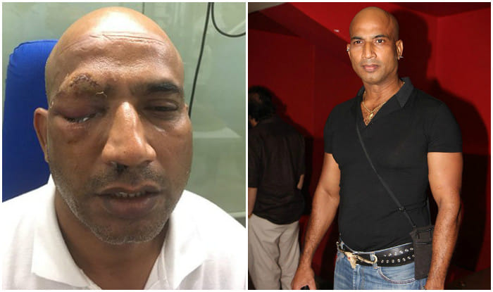 Actor Jeetu Verma attacked by miscreants in Rajasthan, suffers grave eye damage