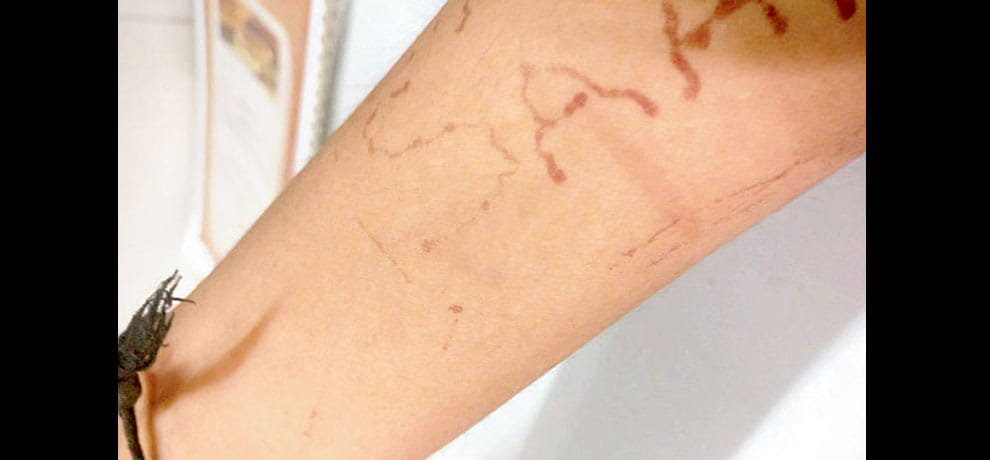 husband and his family arrested for torturing a woman in mumbai
