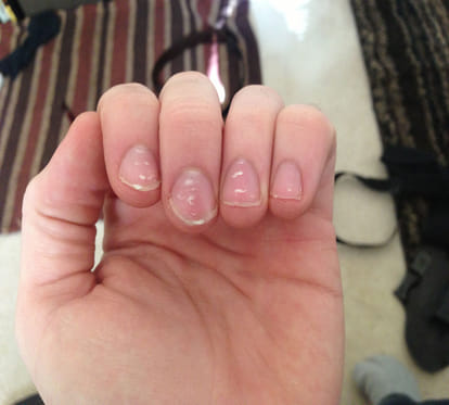 nails indicate your luck