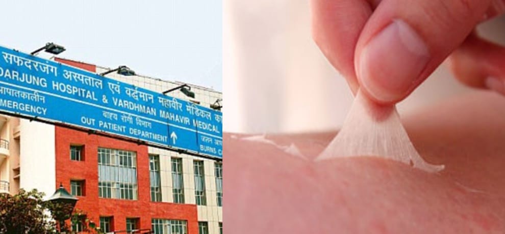Delhi doctors harvest skin from the cadaver of an 81-year-old man to transplant to burns victims