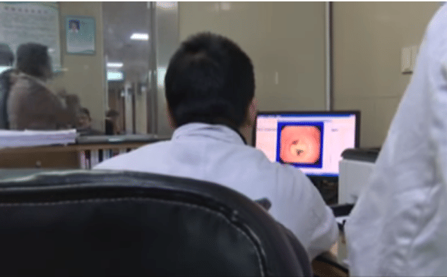 Woman Had Mushrooms Removed By Doctors That Started Growing Inside Her Stomach