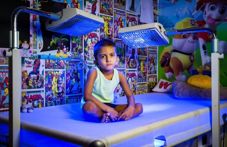 Boy, 4, must spend 20 hours a day under bright lights 