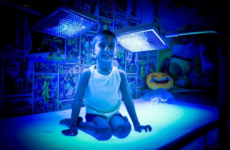 Boy, 4, must spend 20 hours a day under bright lights 