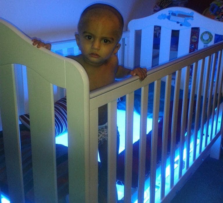 Boy, 4, must spend 20 hours a day under bright lights 