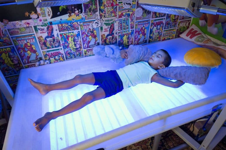 Boy, 4, must spend 20 hours a day under bright lights 