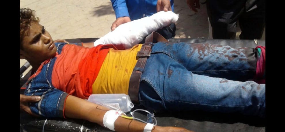 blast during bomb making, injured a man in garmukteshwar 