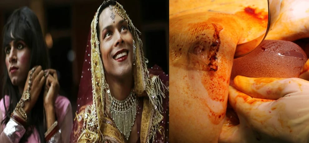 transgender brest implant with money of loot in delhi