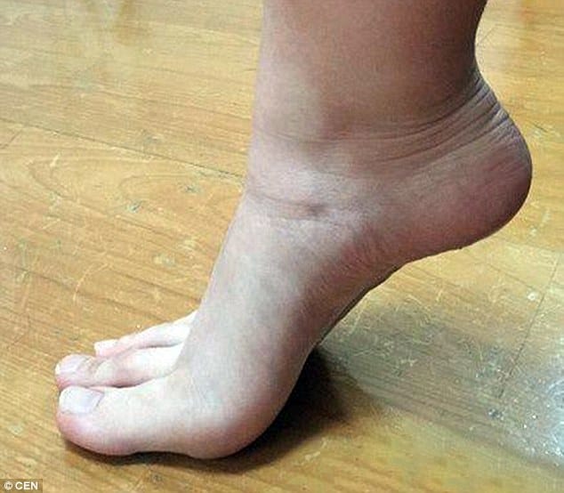 Woman baffles internet after posting pictures of her bizarre digits