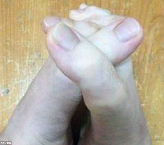 Woman baffles internet after posting pictures of her bizarre digits