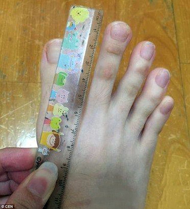 Woman baffles internet after posting pictures of her bizarre digits