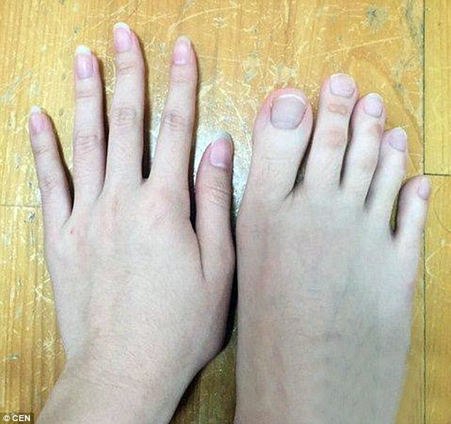 Woman baffles internet after posting pictures of her bizarre digits