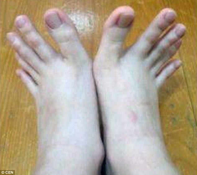 Woman baffles internet after posting pictures of her bizarre digits