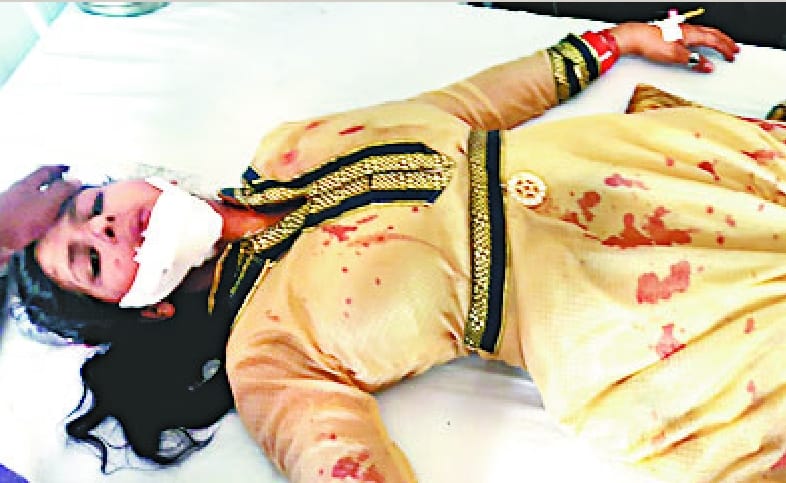 Magic tree collides with 15 injured pilgrims