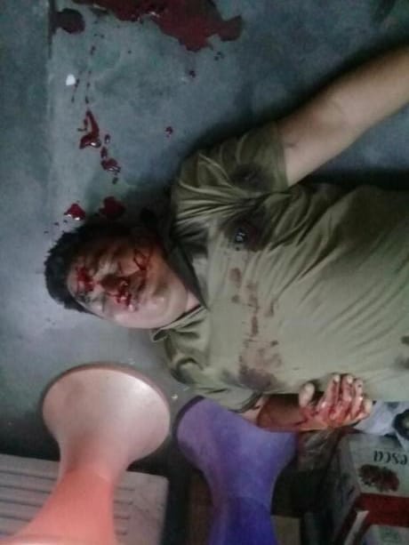 bjp leader shooted at muzaffarnagar khatauli
