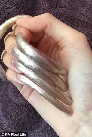 Simone Taylor grows six-inch nails which is now painful.