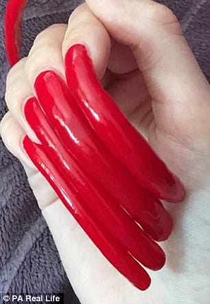 Simone Taylor grows six-inch nails which is now painful.