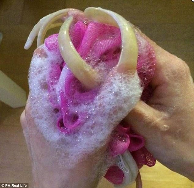 Simone Taylor grows six-inch nails which is now painful.
