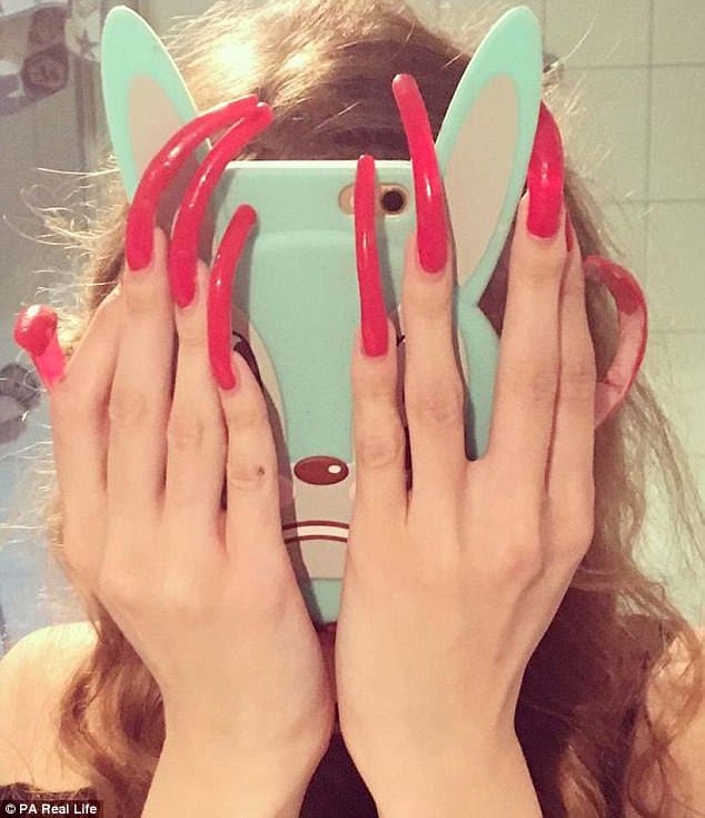 Simone Taylor grows six-inch nails which is now painful.