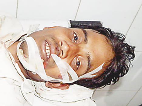 Four injured, four injured in critical condition