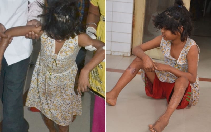 truth about viral mowgli girl found in bahraich jungle