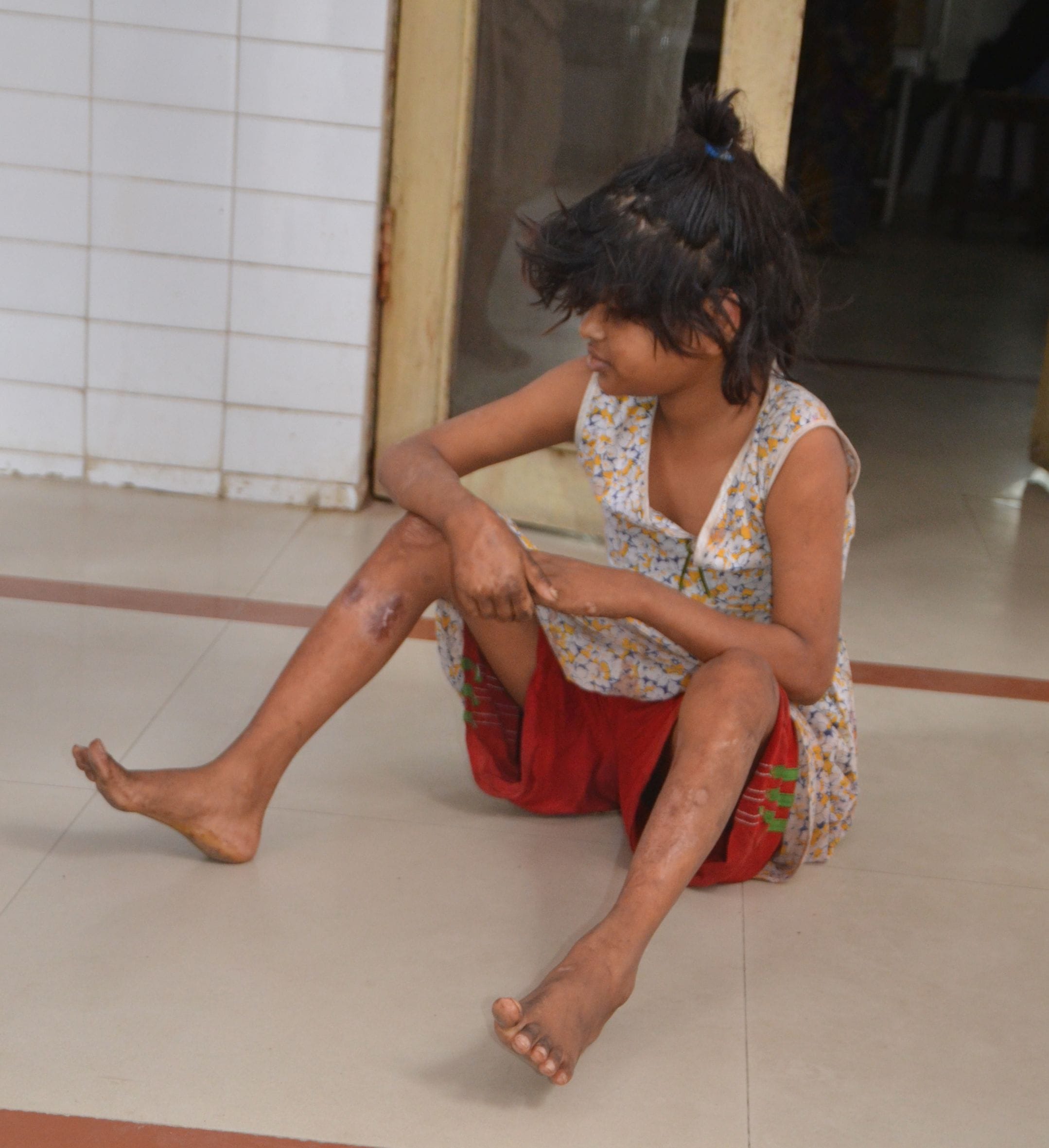 truth about viral mowgli girl found in bahraich jungle