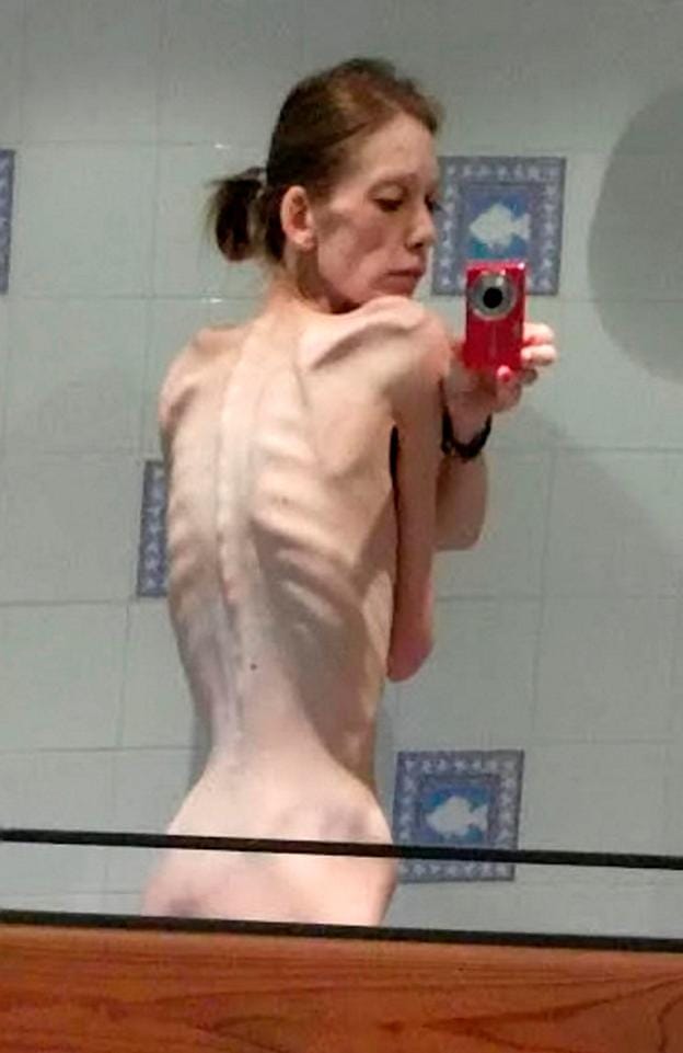 girls fought back against deadly illness to become a champion BODYBUILDER