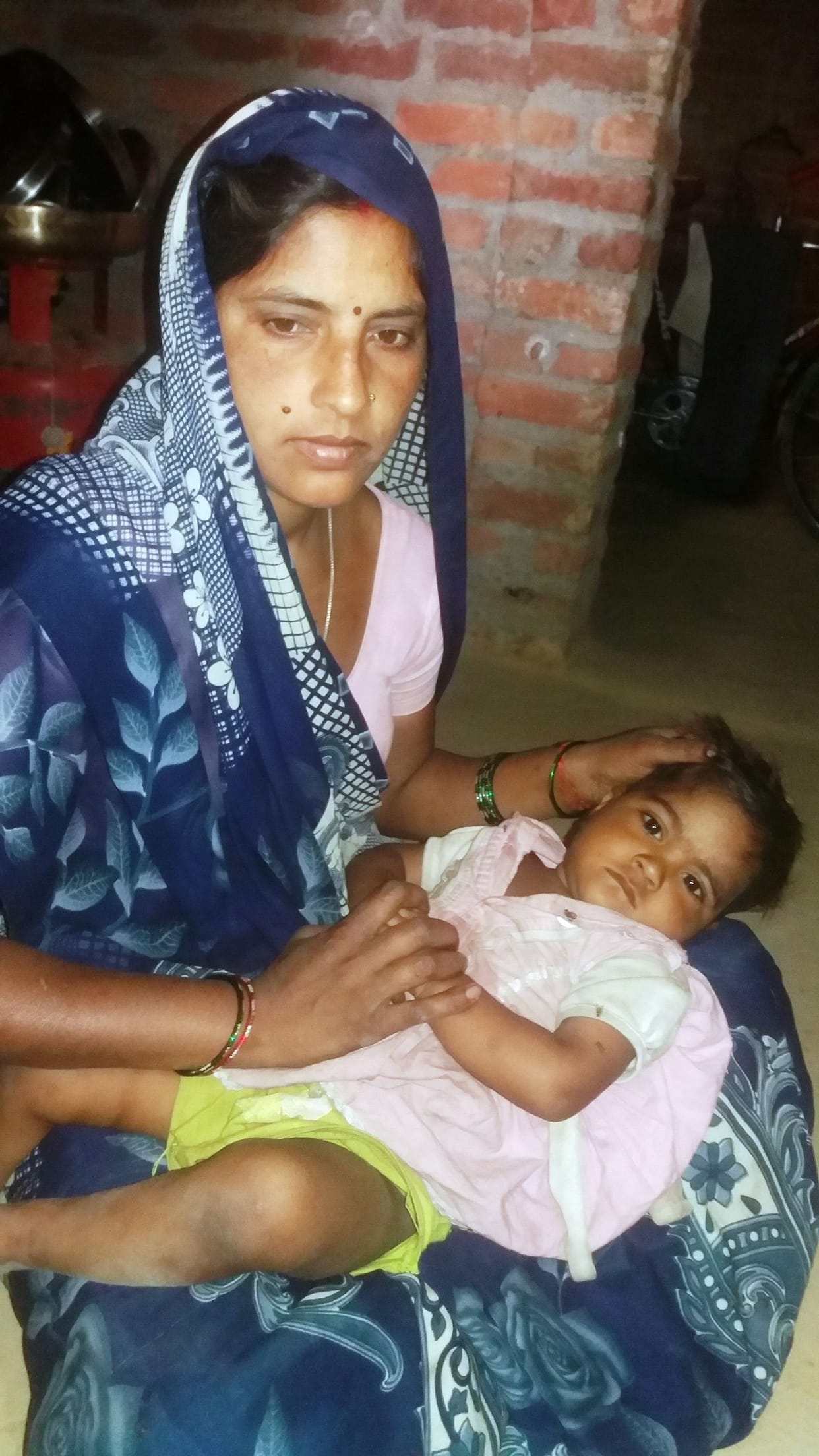 Measles outbreak in Hingala, more than 50 people in grip