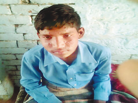 Measles spread in Ramjhanpur, 12 people ill