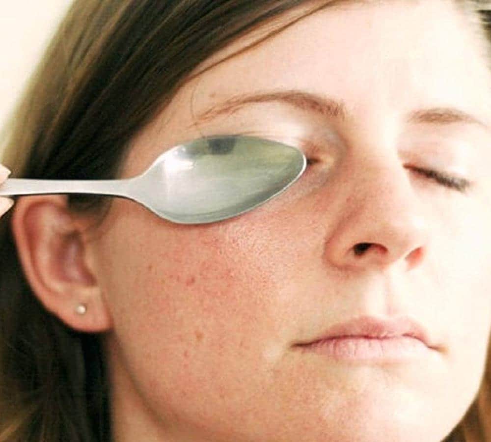 how to get rid of dark circles at home