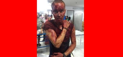 German national was stabbed in north Delhi Kotwali area