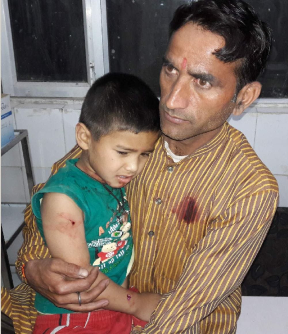  guldar attack on a five year old child