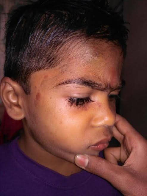 Stepmother beaten son