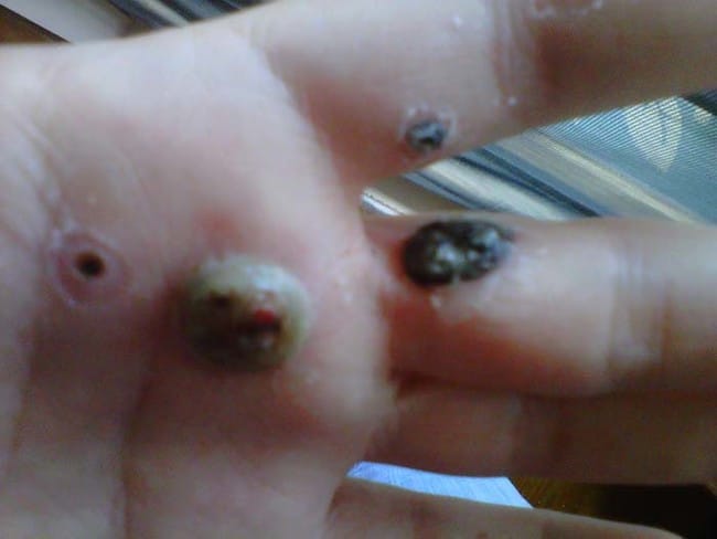 Husband Noticed Mysterious Black Spots On Wife's Hand, What Happened Next Is Simply Haunting!