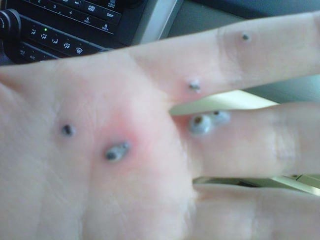 Husband Noticed Mysterious Black Spots On Wife's Hand, What Happened Next Is Simply Haunting!