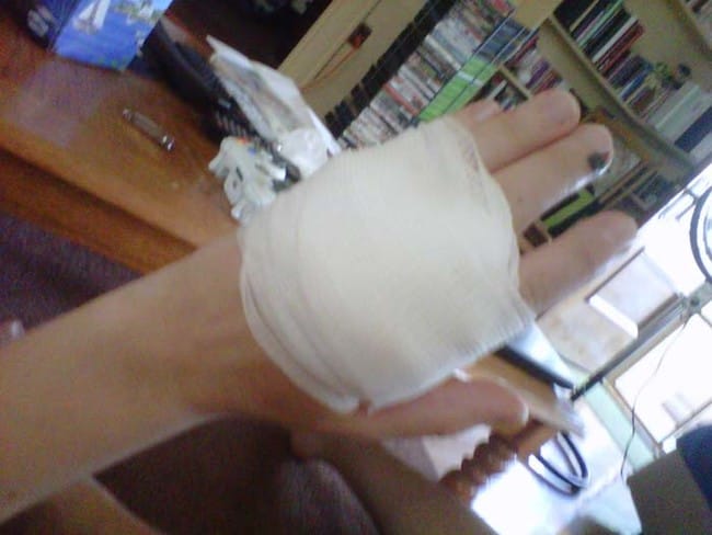 Husband Noticed Mysterious Black Spots On Wife's Hand, What Happened Next Is Simply Haunting!