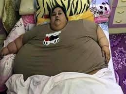 The worlds heaviest woman lost their weight 