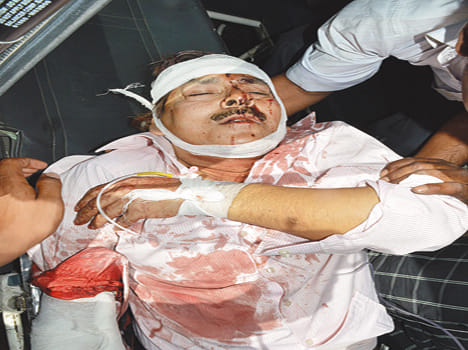 Gold jeweler shot 12 lakhs gold