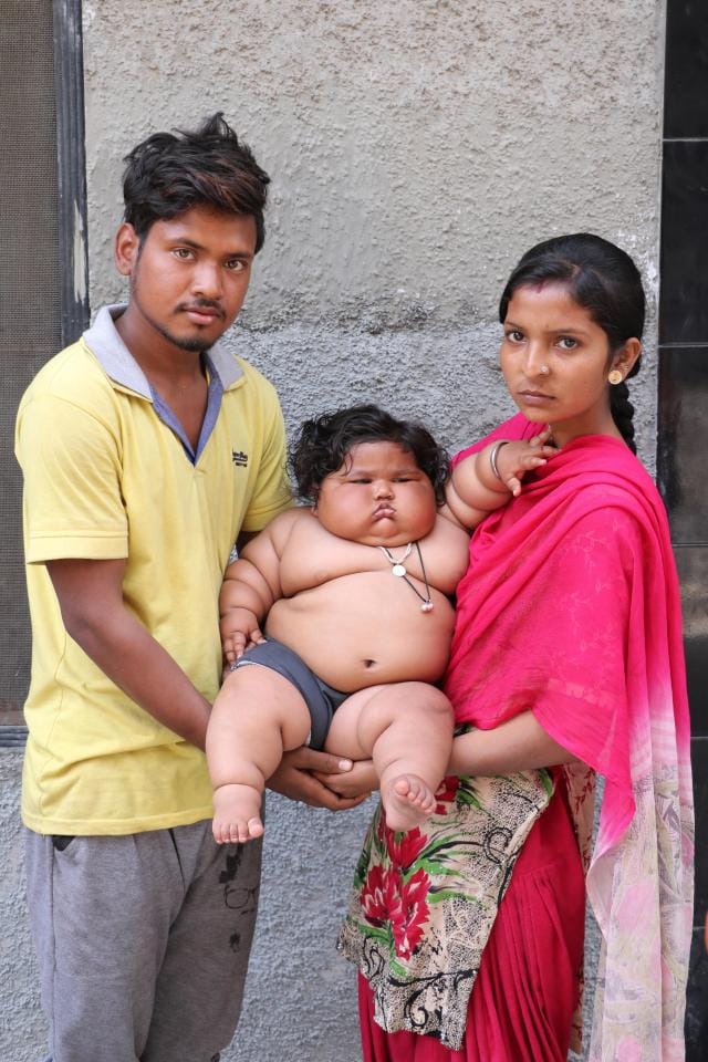 obese baby girl alarms doctors by weighing at just eight months old