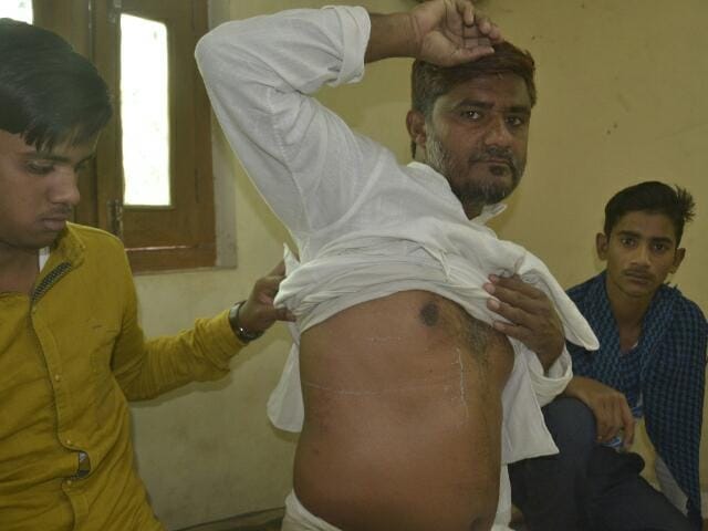 Varanasi: A life-threatening attack on a social worker protesting against triple talaq