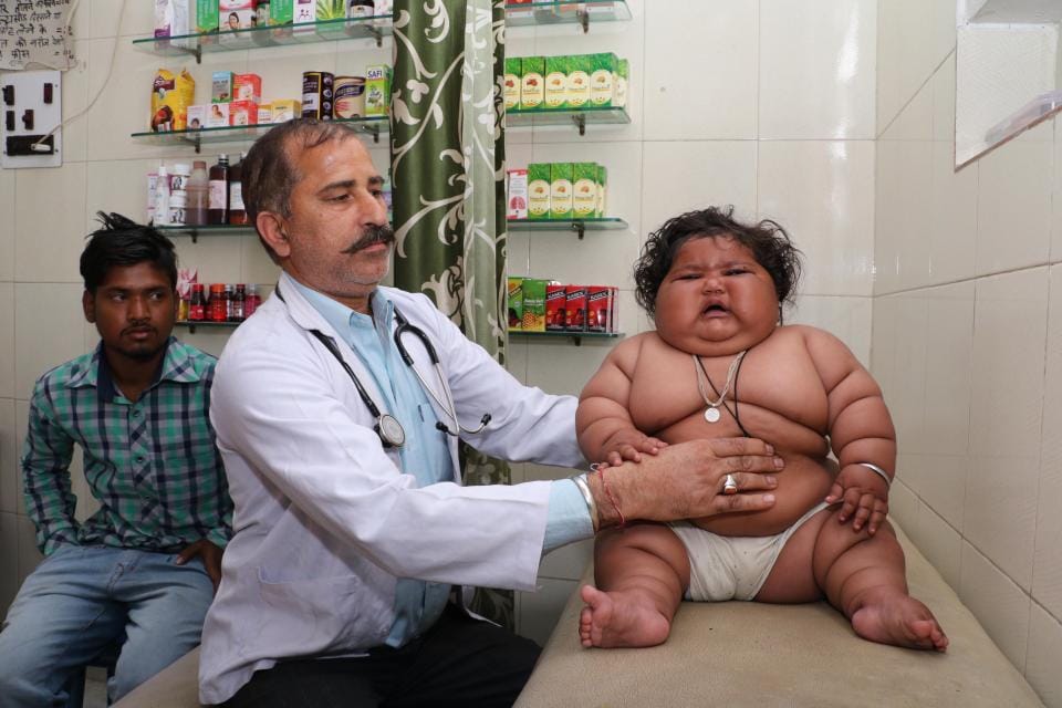 obese baby girl alarms doctors by weighing at just eight months old
