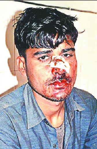 Latha, stone throwing too much, 13 injured