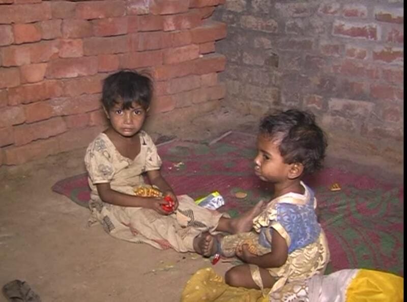  More than 87 thousand children suffering from malnutrition