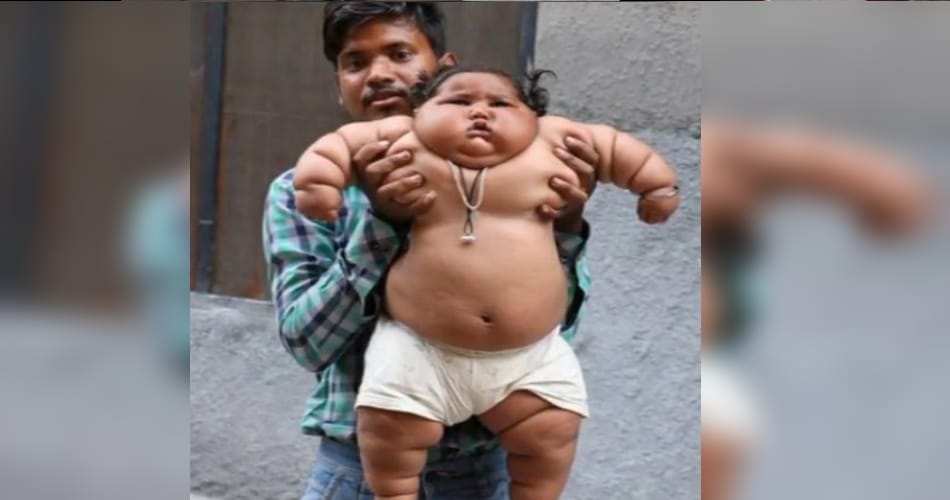 docter surprised ny 8 years baby for his weight 
