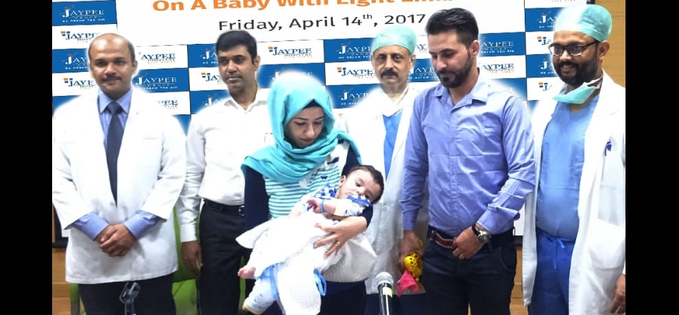 iraq baby with 8 limbs get new life in noida hospital