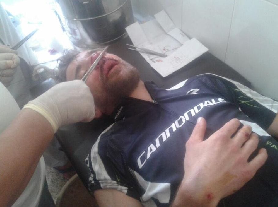 rider injured during cycle rally